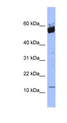Polyclonal Rabbit anti-Human S100A9 / MRP14 Antibody (N-Terminus, WB)