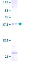 Human TAGLN / Transgelin / SM22 Protein (Recombinant GST)