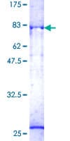 Human PFTK1 / CDK14 Protein (Recombinant GST)