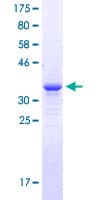 Human AVP / ADH / Vasopressin Protein (Recombinant GST, N-terminus)