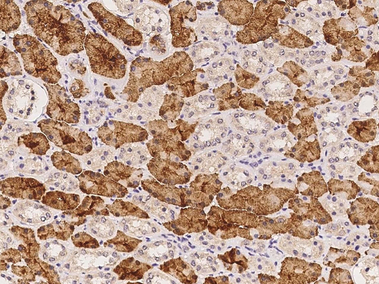 SLC22A6 / OAT1 Antibody