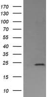 Monoclonal Mouse anti-Human DPCD Antibody (clone OTI8A12, IHC, IF, WB)