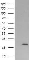 CTAG1B / NY-ESO-1 Antibody (clone OTI9E7)