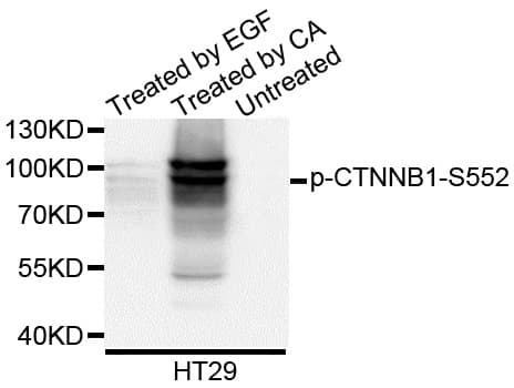 Polyclonal Rabbit anti-Human CTNNB1 / Beta Catenin Antibody (phospho-Ser552, WB)