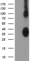 ZFP36 / Tristetraprolin Antibody (clone OTI1F2)