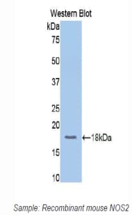 NOS2 / iNOS Antibody (aa526-659, APC)