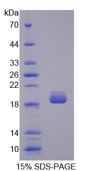 Rat SHH / Sonic Hedgehog Protein (Recombinant His)