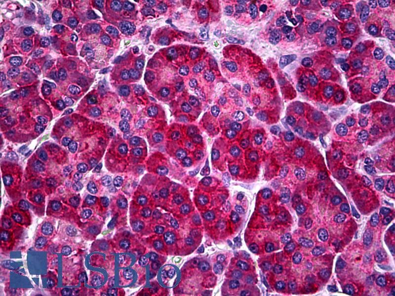 PathPlus™ Monoclonal Mouse anti-Human CALR / Calreticulin Antibody (clone 1G11-1A9, IHC, WB)