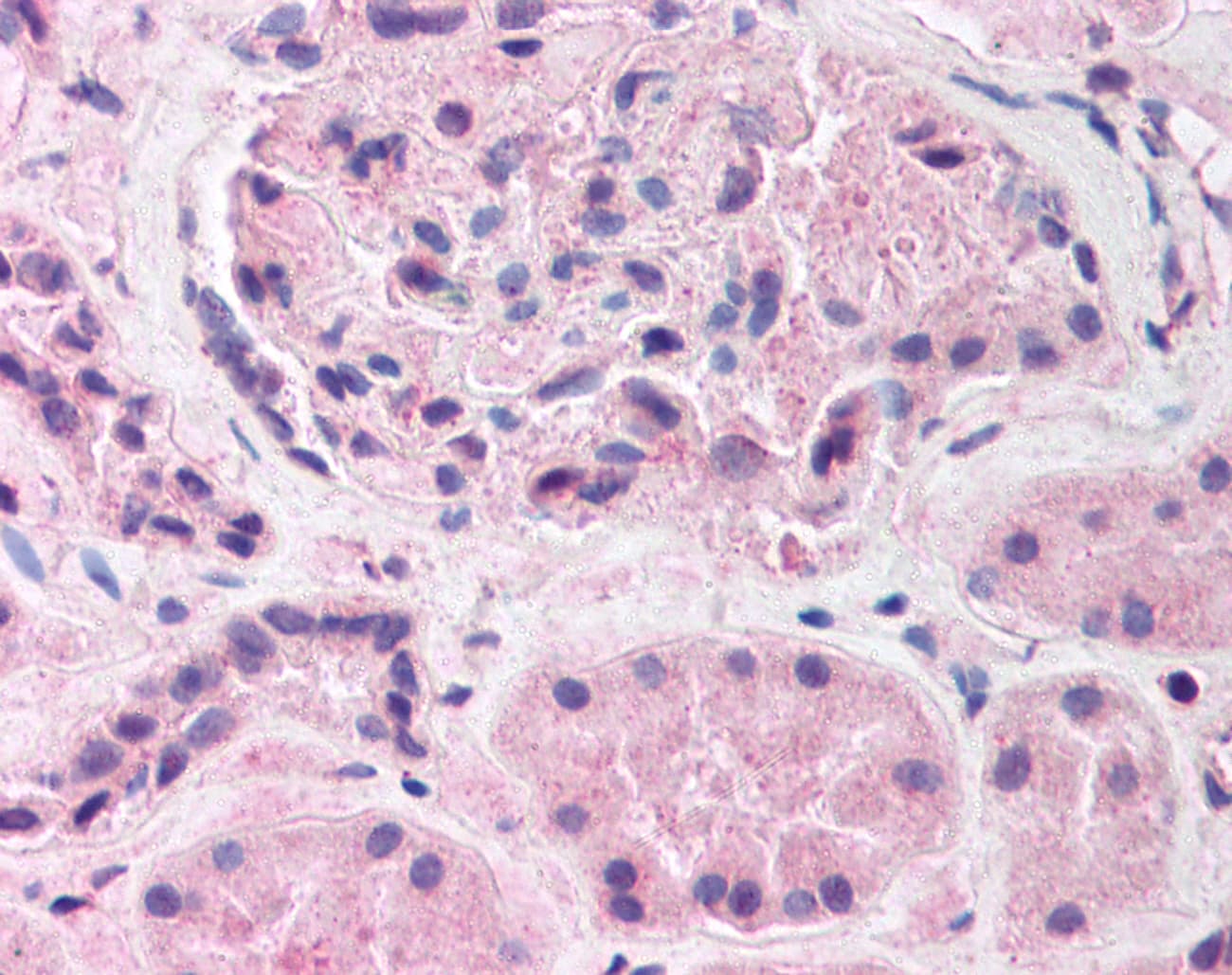 IHC-plus™ HIF1A / HIF1 Alpha Antibody (aa329-530, clone ESEE122)
