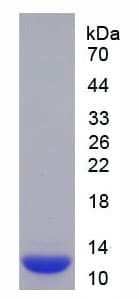 Human S100A10 Protein (Recombinant 6His, N-terminus)