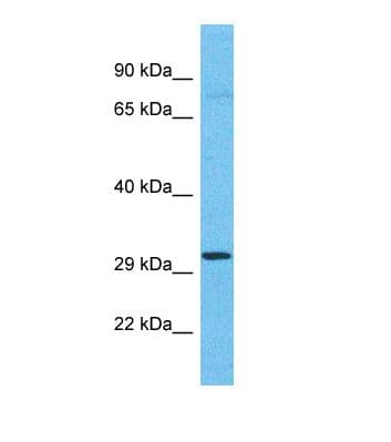 OR4C11 Antibody (C-Terminus)