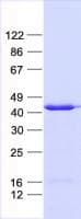 Human CARP / ANKRD1 Protein (Recombinant His, N-Terminal)