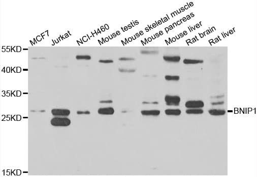 Polyclonal Rabbit anti-Human BNIP1 Antibody (IHC, WB)