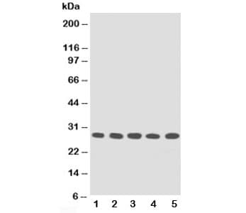 Polyclonal Rabbit anti-Human TFPI2 Antibody (aa170-186, IHC, WB)