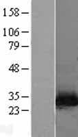 NNMT Protein (Over-Expression Lysate Myc-DDK (Flag))