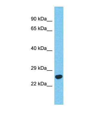 BCKDHB Antibody (aa34-83)