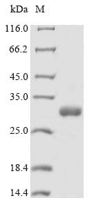 Synsepalum dulcificum Miraculin Protein (Recombinant 6His, N-terminus)