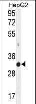 Polyclonal Rabbit anti-Human MED6 Antibody (aa217-246, WB)