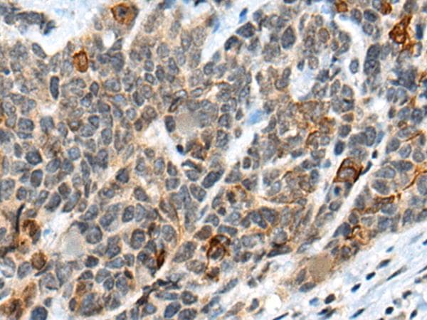 ATRX Antibody