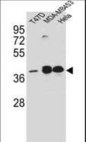 Polyclonal Rabbit anti-Human ESR2 / ER Beta Antibody (aa211-240, WB)