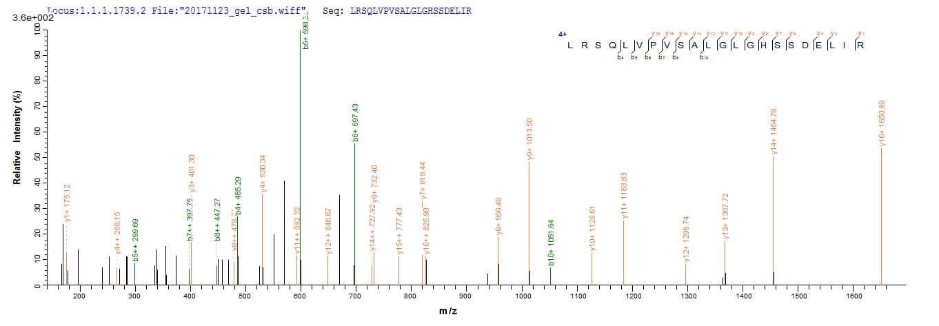 Rat ARTN / Artemin Protein (Recombinant 10His, N-terminus + Myc, C-terminus)