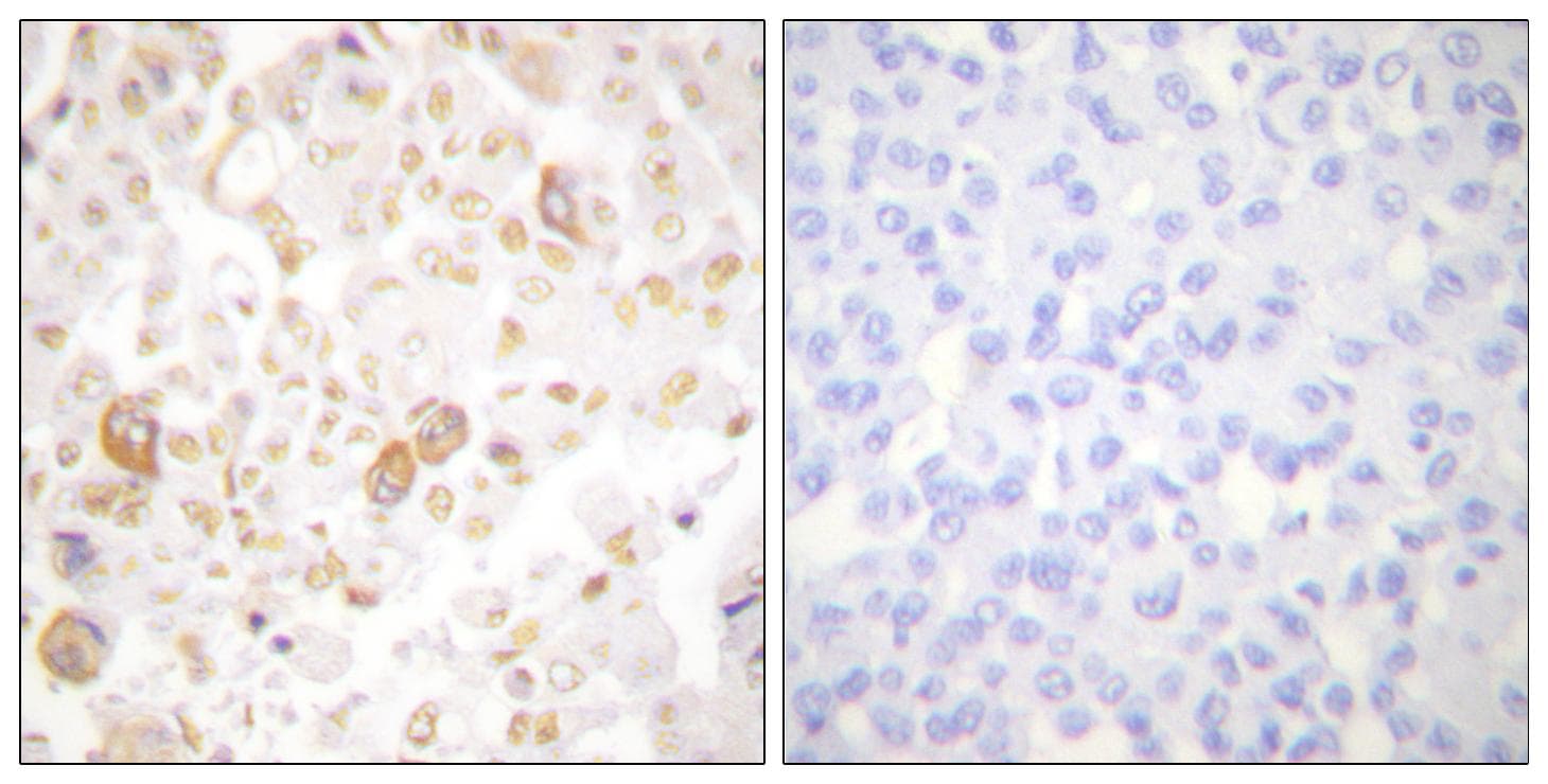 CCNF / Cyclin F Antibody