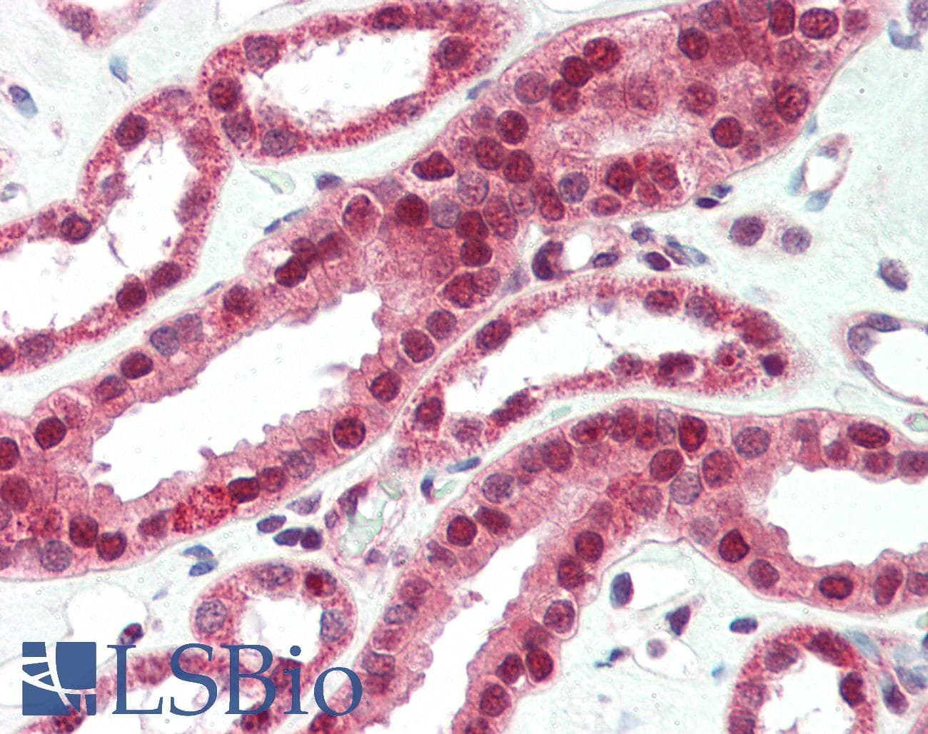 IHC-plus™ Polyclonal Rabbit anti-Human TOCA1 / FNBP1L Antibody (IHC, IF, WB)