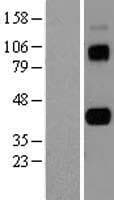 Human AIM / CD5L Protein (Over-Expression Lysate Myc-DDK (Flag))