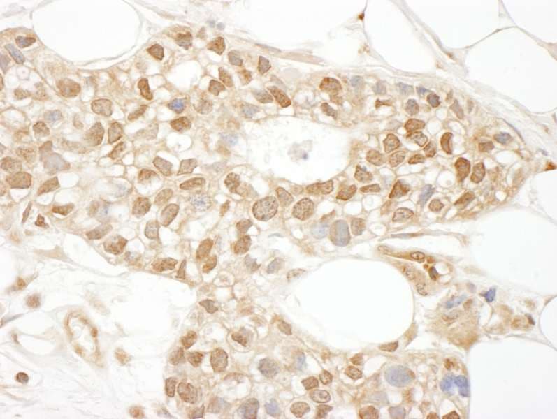 BSAC / MKL1 Antibody (aa700-750)
