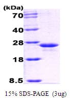 E. coli Glucose Regulated Protein E / GrpE (Recombinant)