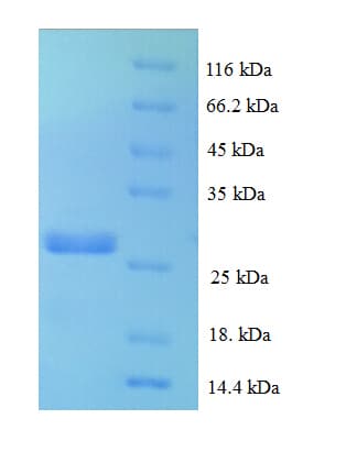 Human CCL16 / LEC Protein (Recombinant His-SUMO)