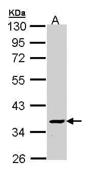 ATP6V1C2 Antibody (aa3-237)