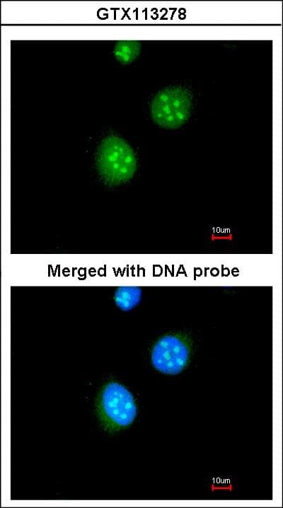 NR1A2 / THRB Antibody