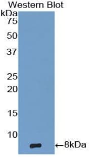 EGF Antibody (aa971-1023)