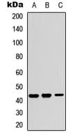Polyclonal Rabbit anti-Human KCNJ15 / KIR4.2 Antibody (Internal, WB)