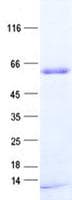 Human PNMA3 Protein (Recombinant His, N-Terminal)