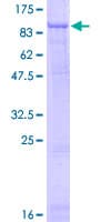 Human SCNN1G / ENaC Gamma Protein (Recombinant GST)