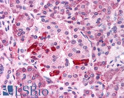IHC-plus™ TRPM4 Antibody (C-Terminus)