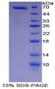 Pig LF / LTF / Lactoferrin Protein (Recombinant His-GST)