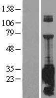 SNAP25 Protein (Over-Expression Lysate Myc-DDK (Flag))