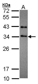 Polyclonal Rabbit anti-Human SET / TAF-I Antibody (aa1-45, IHC, WB)