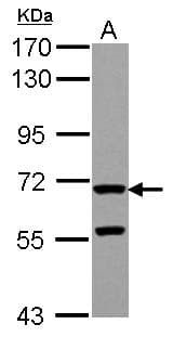ZP2 Antibody