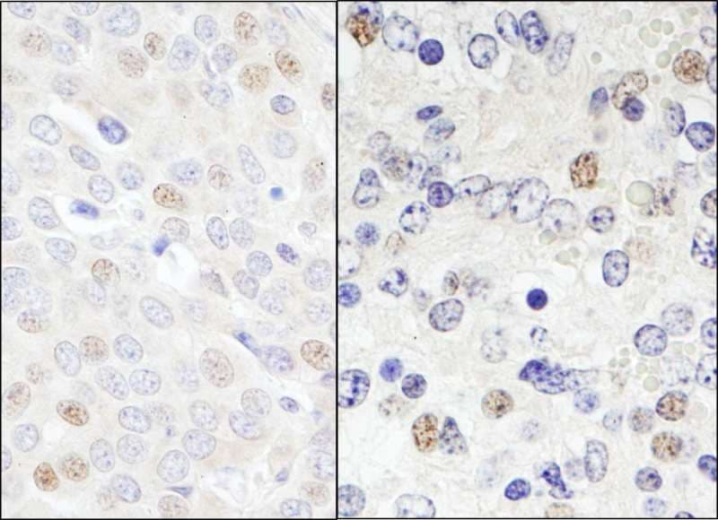 DDX46 Antibody (aa300-350)