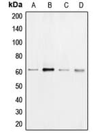 Polyclonal Rabbit anti-Human BRAF / B-Raf Antibody (Internal, IHC, IF, WB)