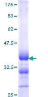 Human CALCA Protein (Recombinant GST, N-terminus)