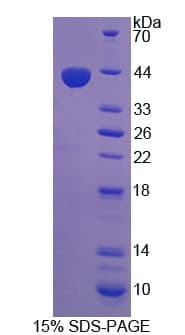 Human PC5 / PCSK5 Protein (Recombinant His, N-Terminal)