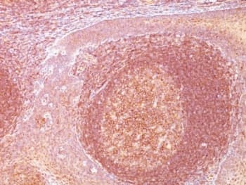 BCL10 / BCL-10 Antibody (aa122-168, clone SPM520)