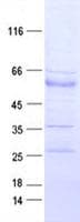 Human EPHB3 / EPH Receptor B3 Protein (Recombinant DDK,C-terminus)