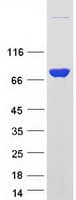 Human EZR / Ezrin Protein (Recombinant Myc-DDK (Flag))