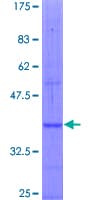 Human NPR3 Protein (Recombinant GST, N-terminus)